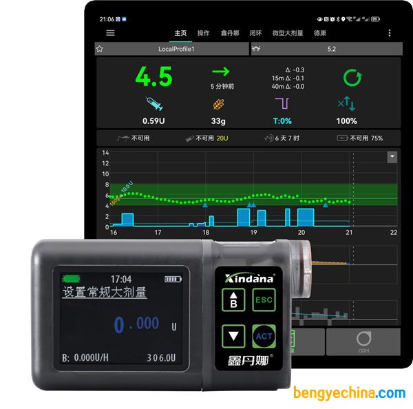 鑫丹娜闭环胰岛素泵